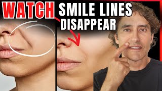 Nasolabial Folds DIY Hacks vs MedSpa Solutions [upl. by Abshier]