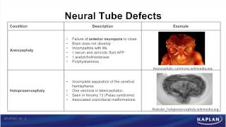 USMLE® Step 1 Neuroscience Development of CNS Animation [upl. by Dedric]