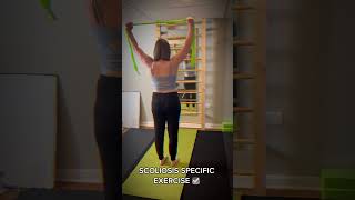 Schroth Method exercises custom to your specific scoliosis curve scoliosistreatment scoliosis [upl. by Airemahs859]