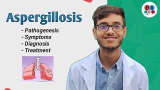 Aspergillus fumigatus  Aspergillosis  Aspergillioma  Microbiology bangla lecture [upl. by Adien]