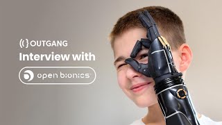 Using Blender and 3d Printing to Make Bionic Arms  Open Bionics Interview [upl. by Odelet]