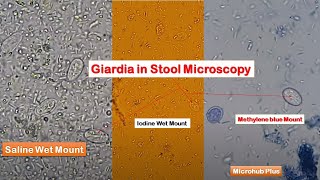 Giardia in Stool Microscopy using variety of Techniques [upl. by Estey]