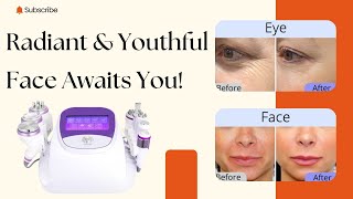 Brighten amp Revitalize Your Face with Cavitation Machine Facial Treatment  Model SD9XS1 [upl. by Gilberto]