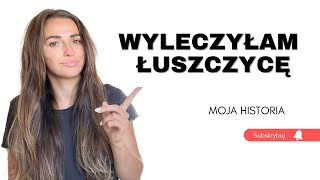 Wyleczyłam ŁUSZCZYCĘ bez leków   English Subtitles [upl. by Marlo]