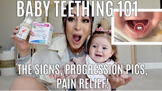 Baby TEETHING The SURE SIGNS PROGRESSION PICS Teethers amp Remedies [upl. by Sipple]