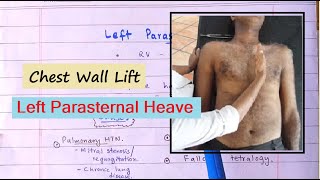 Clinical Sign Of Right Ventricular Hypertrophy  Left Parasternal Heave How To Palpate [upl. by Kalli]