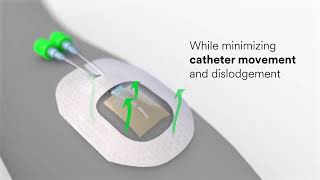 3M™ Tegaderm™ CHG Dressing Science Video [upl. by Debra913]