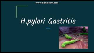 Helicobacter pylori gastritis Pathogenesis and morphology [upl. by Hoebart]