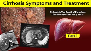 Liver Cirrhosis Symptoms and Treatment  Part1  Hepatitis  Liver Problem Symptoms  HealthWisdom [upl. by Yelbmik419]