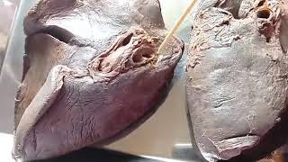 LUNG BANGLA DEMO  RELATION OF HILUM  ANATOMY  MBBS [upl. by Vary239]