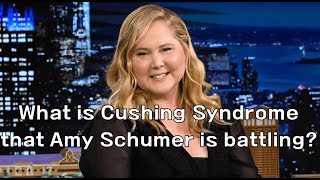 What is Cushing Syndrome that Amy Schumer is battling [upl. by Drugi]