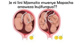 Je Mama Mjamzito mwenye Mapacha anaweza kujifungua wiki ya ngapi Uchungu wa kawaida huanza lini [upl. by Latsyrd]