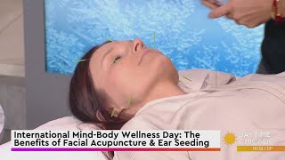 International MindBody Wellness Day The Benefits of Facial Acupuncture amp Ear Seeding [upl. by Shaefer]