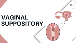 Vaginal Suppository Insertion  How to put It Safely and Easily [upl. by Aifos228]