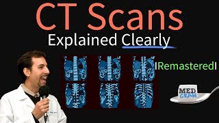 High Resolution CT Scan HRCT Explained Clearly  Remastered [upl. by Nirik373]