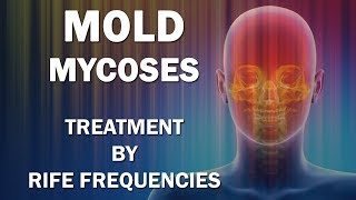 Mold and Mycoses Fungus Diseases  RIFE Frequencies Treatment  Energy amp Quantum Medicine [upl. by Asiulairam]