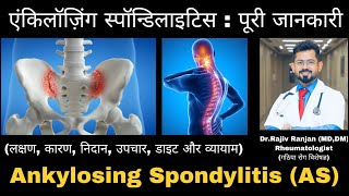 एंकिलॉज़िंग स्पॉन्डिलाइटिस  पूरी जानकारी  All about Ankylosing Spondylitis  HLAB27 Arthritis [upl. by Aiahc425]