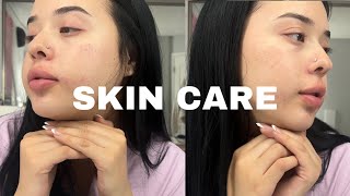 UPDATED SKINCARE  ACNE PRONE 🤍 [upl. by Marieann]