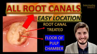 How to FIND THEM Teeth After Root Canal Treatment Video Dental Anatomy Lecture amp Endodontics [upl. by Hashimoto]