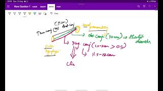 Human Pelvis  Anatomy  Obstetrics  OG  Easy notes  MeDTecH29 [upl. by Laban]