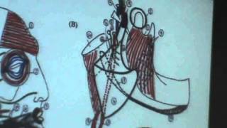 5 DrAhmed Galal 19102014  Parotid gland [upl. by Forrester643]