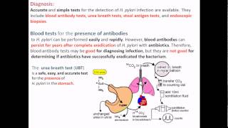 Helicobacter pylori diagnosis [upl. by Kerge308]