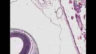 Histopathology Fallopian tubeEctopic pregnancy with embryo [upl. by Jacobson]