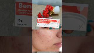 Benclin gel uses in Urdu Benclin gel for acne shorts benclingel removeacne [upl. by Ainnek]