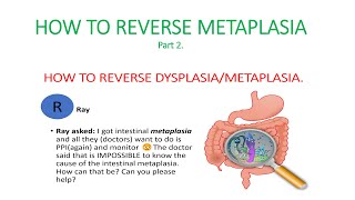 Metaplasia dysplasia How to reverse dysplasia metaplasia Causes of metaplasia [upl. by Annam752]