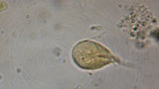 Giardia Lamblia CIAB wwwciabes [upl. by Ethyl]