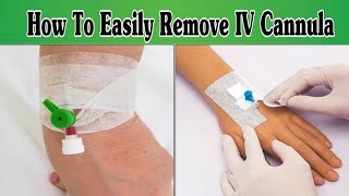 IV Cannula Removal Procedure  Tips and Tricks [upl. by Benji]