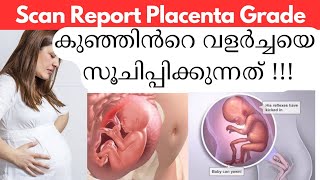 Scan Report Placenta Grade Postion കുഞ്ഞിൻ്റെ വളർച്ചയെ സൂചിപ്പിക്കുന്നത്Placenta Position Malayalam [upl. by Sirehc995]