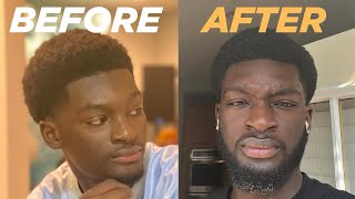 How to Grow a Full Beard in 6 Months  My Proven Beard Growth Journey [upl. by Akilaz]