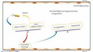 Sepsis development and progression [upl. by Einnhoj]