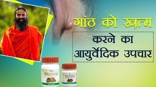 Ayurvedic Treatment for Lipoma गांठ  Swami Ramdev [upl. by Akinihs822]