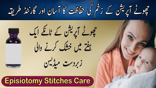 Chota Operation Recovery In Urdu  सामान्य प्रसव के टांके की घर पर देखभाल  Episiotomy Stitches Care [upl. by Mcclary]