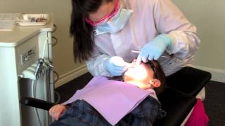 Silver Nitrate  Fluoride Varish Protocol [upl. by Ettelorahc272]