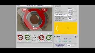 Retinoscopy Simulator Tutorial  Retinoscopy part 2 [upl. by Ahsitauq]