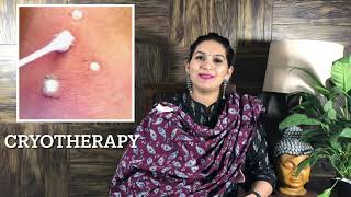 Molluscum Contagiosum Treatment  What is Molluscum contagiosum  Red bumps on face  मस्से का इलाज [upl. by Asiul643]