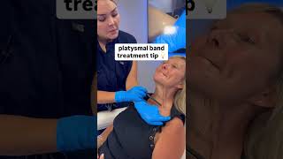 Platysmal band treatment tip [upl. by Hewett]