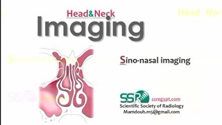 Imaging of Paranasal sinuses DRE Prof Mamdouh Mahfouz [upl. by Gillmore]