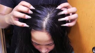 Fast amp Aggressive ASMR Scratch Itchy Scalp So I Did Satisfying Scalp Scratching  No Talking [upl. by Kazimir]