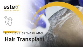 10th Day Hair Wash After Hair Transplant hairtransplantturkey estemedicalgroupistanbul [upl. by Refanej896]