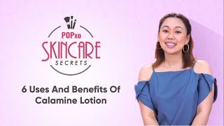 6 Uses And Benefits Of Calamine Lotion  POPxo Skincare Secrets [upl. by Hayikaz]