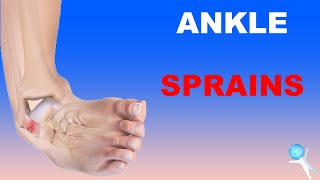 Ankle Sprains  Lateral and Deltoid Ligaments High Ankle Sprains [upl. by Ydiarf]