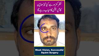 ٹیڑھاپن اور کمزور نظر  Weak Vision Successful Squint Surgery [upl. by Asyal463]