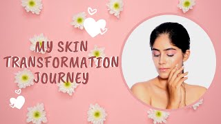 My Acne Journey and SkinCare Tips  StoryTime  Nikita Tanwani [upl. by Trillby97]