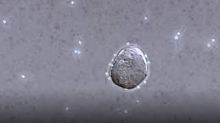 Sperm switch swimming patterns to locate egg [upl. by Rafaelia344]