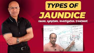 Types Of Jaundice  Causes Symptoms amp Treatment  Dr Najeeb [upl. by Atsugua]