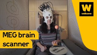 Designing a new brain scanner MEG  Wellcome [upl. by Reiner]